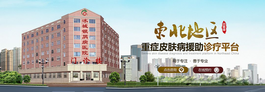 哈尔滨冰城银屑病医院