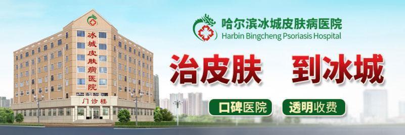 银屑病专科医院